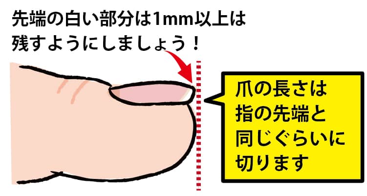 巻き爪にならないための爪の切り方
