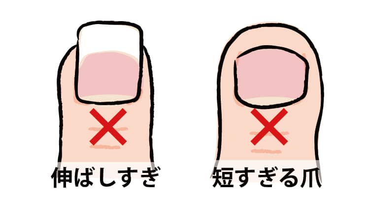 巻き爪にならないための爪の切り方